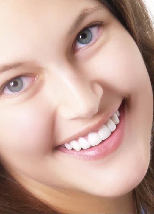 Darya Divisenko smiling after her smile makeover
