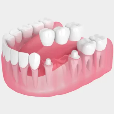 dentist in Rocklin, CA